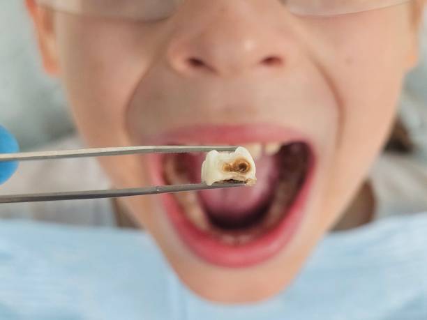 Best Pediatric Emergency Dentist in Jefferson Hills, PA